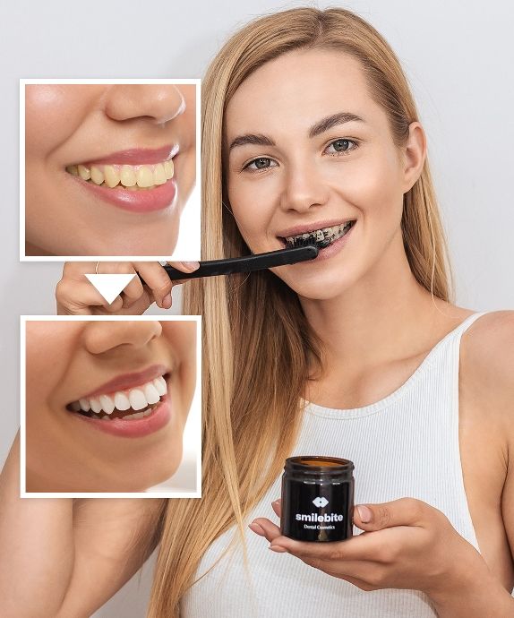 Smilebite coconut charcoal teeth whitening powder